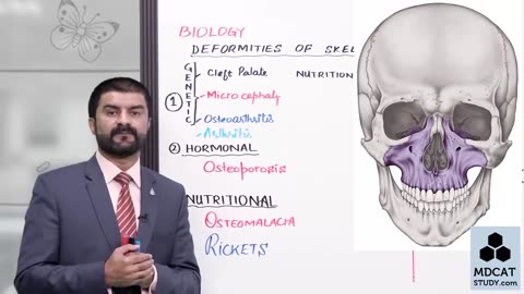 LEC#11 DEFORMITIES OF SKELETON