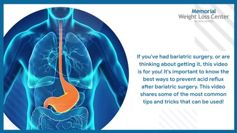 Keeping Acid Reflux at Bay After Weight Loss Surgery