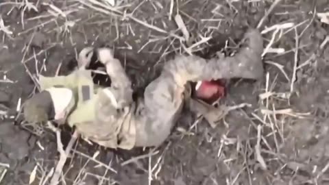 Russian soldier with lost foot , dodges Grenade