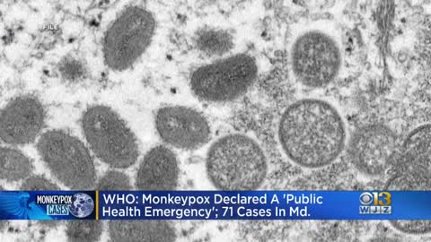 Maryland has 71 monkeypox cases amid global health emergency