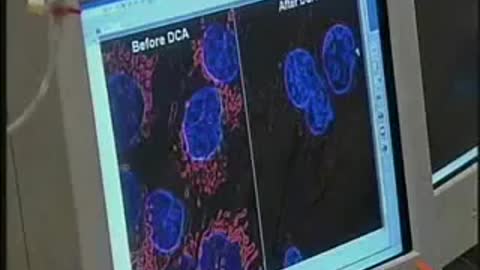 News report on cancer cure dichloroacetate DCA