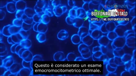 aspetto del sangue prima e dopo il vaccino