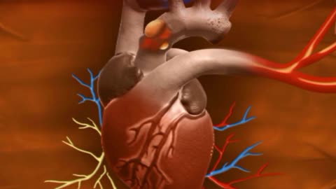 Heart operation video animation