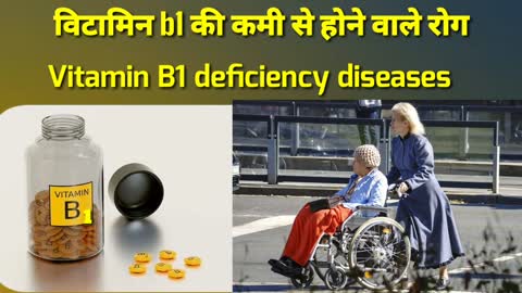 Vitamin B1 supplements, sources of vitamin B1, Vitamin B1 deficiency diseases