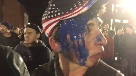 Jan 20 2017 University Washington 1.1 high school Sr was attacked by Antifa/left-wing rioters