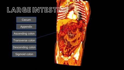 Large Intestine and Umbilical Hernias