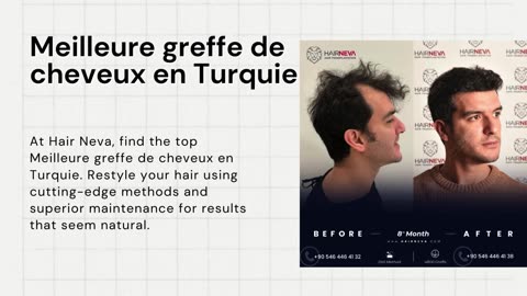 Meilleure greffe de cheveux en Turquie