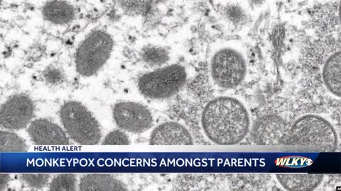 How to protect your children from monkeypox