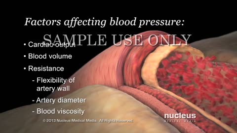 HIGH BLOOD PRESSURE 😧Most death causing disease worlwide #bloodpressure