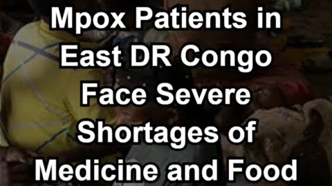 Mpox Patients in East DR Congo Face Severe Shortages of Medicine and Food