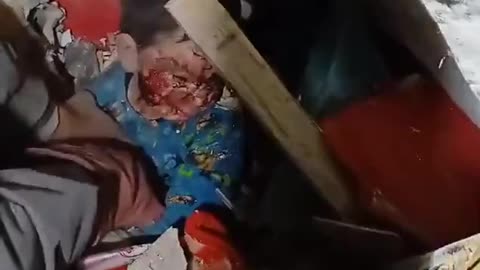 Lebanese child, Hassan Ali Amer, who was pulled out of the rubble