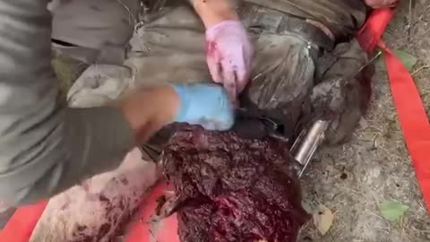 🇷🇺🇺🇦Video from one of the Ukrainian Armed Forces medics