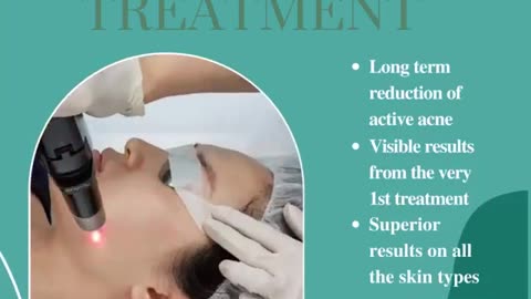 Laser acne treatment clinic in Edmonton | Acne treatment