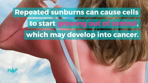 Top Reasons Why Sun Exposure Can Give You Skin Cancer