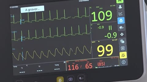 COVID-19: Associação de Médicos pede cautela