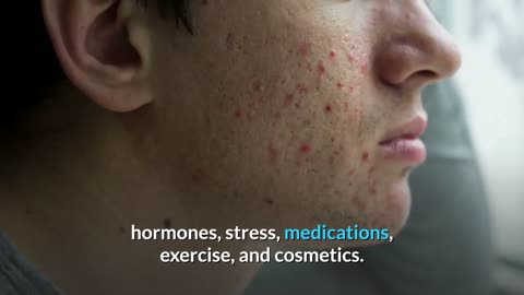 The Plain Truth About Acne