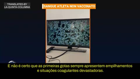 Dr Italiano, Explica Que Viu no Sangue dos Vacinados, Antenas.