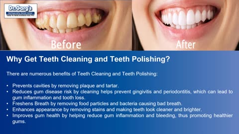 Your Path to a Cleaner Smile: An Introduction to Teeth Scaling and Cleaning