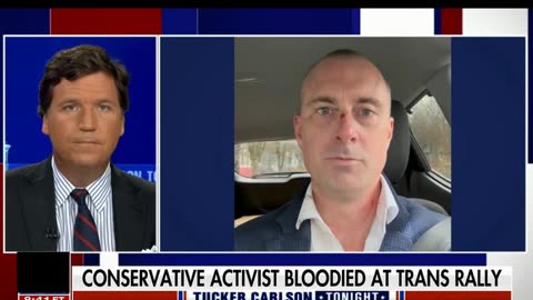 TUCKER CARLSON: The most shocking video of the year unreal. Trans woman uses full male force an innocent by standard cuts his face and criminal cop lies, Vancouver police chief backs the lying political cop on video. All documented on VIDEO WOW. Vancouver