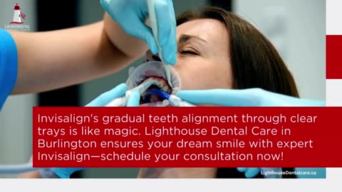 How Invisalign Functions