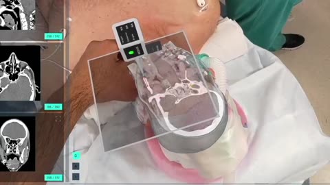 Revolutionizing Healthcare: The Synergy of AR and AI