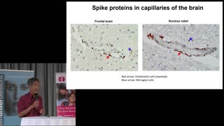 Prof. Sucharit Bhakdi: The danger of mRNA Vaccines (Englisch)