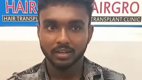 7 Months Hair Transplant Result