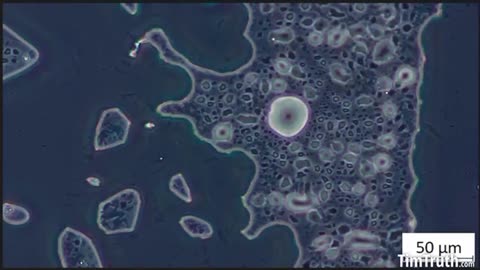 Microscopy analysis of a Pfizer-BioNTech Covid "vaccine" sample.