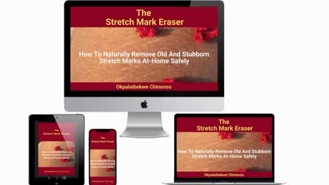 Stretch mark Eraser treatment