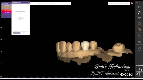 #design #naildesign #dental #dentaldesign #exocadexpert