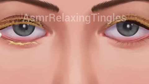 ASMR eye cleaning Treatment👁wait for the relaxing moment😍