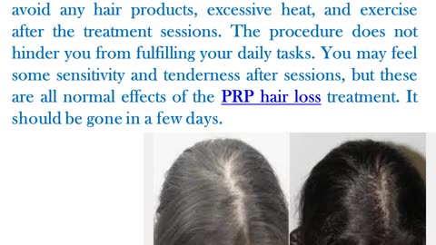 Effective PRP Treatment for Hair Loss in NYC