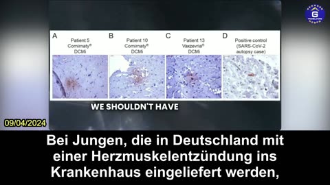 【DE】Dr. McCullough: Viele Studien zeigen, dass der COVID-Impfstoff das Herz schädigt.