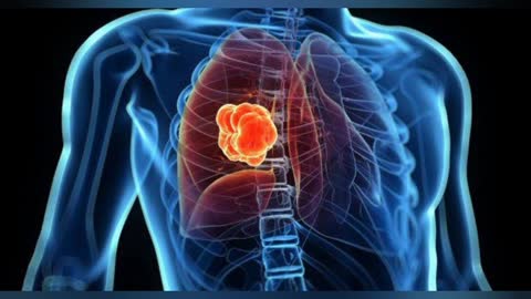 Causes of breath shortness other than corona