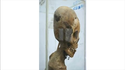 The Elongated Skulls Of Paracas Peru And Their DNA