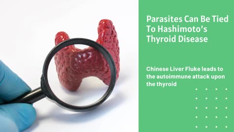 Hashimoto's Thyroid & Parasites