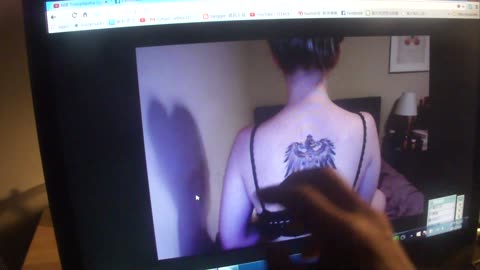 Luodong Online Treatment For White Woman With Back Tattoo