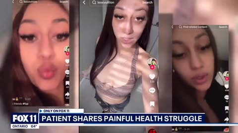 California woman, 23, turns purple after vaccination at a hospital