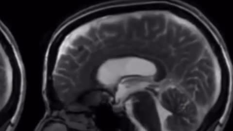 Watch this rare footage of the brain in motion acquired by researchers at Stanford in 2018!