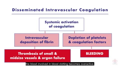 Dr Rochagné Kilian - Blows the Whistle on Covid-19 Vaccines and D-Dimer Levels