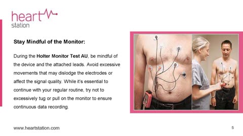 Maximizing Holter Monitor Test Accuracy With Dos and Don’ts