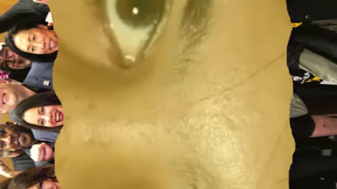 Pimple popping and blackhead