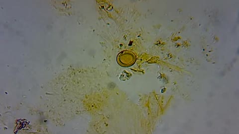 Taenia Solium Eggs Under the microscope