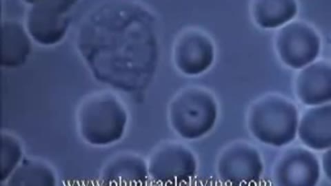 Live Blood Cell Analysis Dr. Robert Young