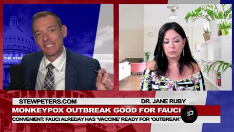 Monkeypox Outbreak Good For Fauci_ Fauci Has Vaccine Ready For Outbreak