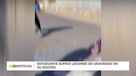 TESTIMONIO DE APODERADA DE ALUMNO AGREDIDO EN OVALLE