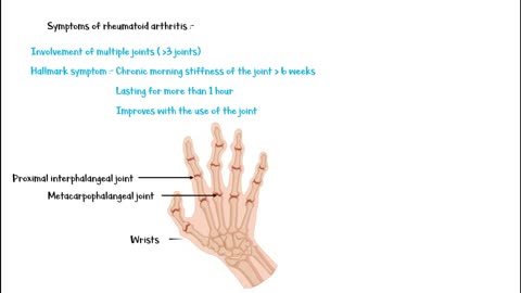 Symptoms Of Rheumatoid Arthritis [Early & Late] What Is Rheumatoid Arthritis & How It Affects you