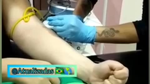 Menina foi tirar sangue e o seu sangue está coagulando, "pós picada".