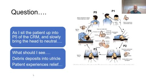 The Epley Maneuver - Position 4 (P4) to Position 5 (P5)