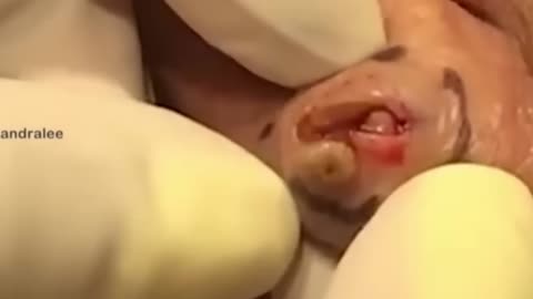 A Big Squirt on the Earlobe